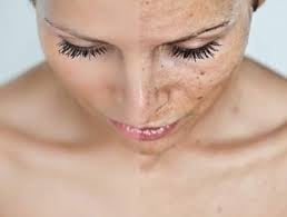 maquiagem para pele manchada