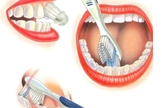 escovação dentes