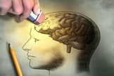 alzheimer
