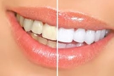 dicas para escovar os dentes