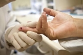 Teste HIV