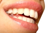 clareador dental