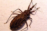 doença de Chagas