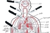 Imagem mostra os pontos principais do corpo a serem atingidos por uma faca, causando rápida fatalidade. (Foto: Times of Israel)