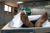 O procedimento não será capaz de dar vida nova às pessoas que faleceram, mas sim, às que vivem somente com o auxílio de aparelhos médicos. (Foto: Reprodução)