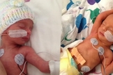 Nico e Camila nasceram na última semana e conheceram os braços de sua mãe. (Foto: Reprodução/ABC 7 News)