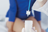 O exame rastreia a presença de lesões pré-cancerosas. (Foto: Reprodução)