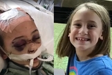 Chloe Clark foi diagnosticada com meningite bacteriana. (Imagem: Facebook)