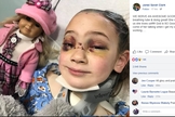 Uma foto da garota já acordada foi publicada pelo pai no hospital. (Foto: Facebook)