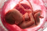 Abortos foram a maior causa de mortes no mundo, em 2018. (Imagem: Aleteia)