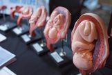 Alegando oferecer "serviços de saúde pública", a Planned Parenthood mascara seus relatórios para esconder os números reais de abortos que opera. (Foto: alaraby.co.uk)