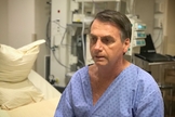 Jair Bolsonaro está sendo submetido a cirurgia para retirada da bolsa de colostomia. (Foto: Divulgação)