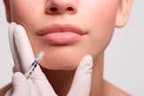 Diversos ativos preenchedores permitem uma boa integração entre os tecidos e um resultado natural. (Foto: Reprodução)