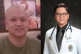 O filipino Albien Emmanuel Gacias venceu um câncer de pulmão e se formou em medicina. (Foto: Reprodução)