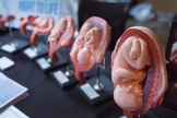 Peças em consultório mostram estágios de um bebê em gestação. (Foto: NY Post)