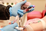 O plasma convalescente é a parte líquida do sangue que acaba sendo coletada de pacientes que se recuperaram de uma infecção. (Foto: TRT)