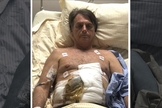 O candidato Jair Bolsonaro foi submetido a uma cirurgia de emergência no intestino. (Foto: Reprodução)