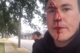 Ryan Roberts ensanguentado após sofrer agressões por causa de seu ativismo pró-vida. (Foto: Reprodução/YouTube).