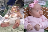 Sarah de Lima hoje, aos três meses; e, à esquerda, quando estava internada na UTI Neonatal com complicações em decorrência da hipoglicemia detectada com um dia de vida. (Foto: Reprodução/Mariane Lima)