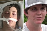 : Caleb quando estava em como e hoje, recuperado. (Foto: Reprodução/WTSP)