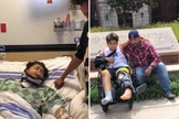 Emilio Corrales itnernado após ser atropelado por semi-caminhão (à esquerda) e em recuperação ao lado do pai. (Foto: Reprodução/CP)
