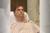 Presidente da República, Jair Bolsonaro com sonda nasogástrica. (Foto: Reprodução/Twitter)