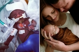 James “Finn” Hill na UTI Neonatal (à esquerda) e com seus pais Chris e Jessica após alta hospitalar. (Foto: Reprodução/Facebook)