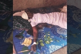 Zubeda Nabirye após tratamento por agressão na aldeia Matovu, no leste de Uganda. (Foto: Morning Star News)