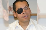 Alex usa um tapa-olho após perder a visão. (Foto: Reprodução / VOM)