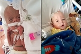 Kingston Lane passou os primeiros 10 meses de vida em uma batalha. (Foto: Brittany Lane/Facebook|WFIE)