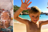Blake após cirurgia, e hoje completamente restaurado. (Foto: Reprodução / Facebook)