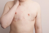  mbar, atualmente com 21 anos. Começou o tratamento hormonal aos 17, fez mastectomia e histerectomia aos 18. “Para mim a transição foi uma espécie de autoflagelação, estava tentando destruir a pessoa que eu era”. (Foto: Laura Dodsworth)