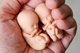 Aumento se deu em função da liberação dos procedimentos em casa em meio à pandemia. (Foto: Reprodução / Right To Life)