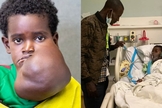 O pai Matios e a filha Haile foram levados a Nova York para a cirurgia de retirada do tumor. (Foto: Reprodução/ Facebook Vascular Waner Children's).
