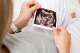 Até janeiro de 2021, mais de 62 milhões de abortos foram realizados nos EUA, desde sua legalização. (Foto: Shutterstock)