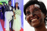 Rebekah em seu casamento com Kaushik; ao lado, após sofrer queimaduras durante ataque em 2019. (Foto: Reprodução / Open Doors)