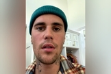 Em vídeo no Instagram, o cantor explicou que foi diagnosticado com a Síndrome de Ramsay Hunt. (Foto: Instagram/Justin Bieber).