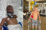 Bodie Boring, de 6 anos, hospitalizado e dias depois recuperado. (Foto: Facebook Sam Boring)
