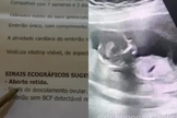 O Dr. Hugo Garcia compartilhou o testemunho, mostrando o bebê vivo no ultrassom. (Foto: Reprodução/Instagram/Dr. Hugo Garcia).