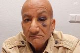 Idoso foi agredido por socos no rosto. (Captura de tela/Omroep West)