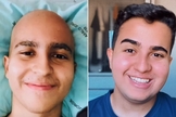 Lucas Teodoro antes e depois do câncer. (Foto: Reprodução/Instagram/Lucas Teodoro)