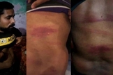 Azam Nasih mostra as marcas após o espancamento. (Foto: Reprodução/Bitter Winter)