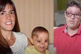 Gray sobreviveu milagrosamente. (Foto: Reprodução/YouTube/American Society of Plastic Surgeons).