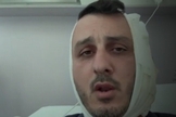 Stav Ben-Shushan após receber atendimento hospitalar por ferimento na orelha. (Captura de tela/Canal 12)