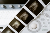 Atualmente, o aborto é permitido até a 24ª semana de gestação. (Foto: Pexels/Mart Production)