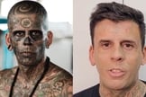Leandro de Souza passou por mais uma sessão de remoção das tatuagens no rosto. (Foto: Arquivo pessoal/Reprodução/Instagram/Hell Tattoo).
