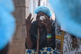 Pacientes que realizaram cirurgias. (Foto: Reprodução/Samaritan's Purse)
