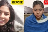 Zarnab Noor antes e depois de ser torturada por seus empregadores muçulmanos. (Foto: Samaritan’s Fellowship Foundation).