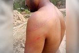 O pastor Motu Sodi após as agressões. (Foto: Reprodução/Morning Star News)