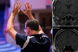 O tumor desapareceu do cérebro do homem no segundo exame. (Foto: Imagem ilustrativa/Unsplash/Jesus Loves Austin/Instagram/Shakersplaces).